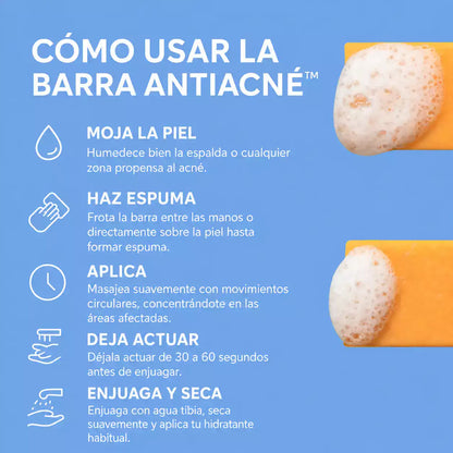 Barra Antiacné para Espalda y Cuerpo™