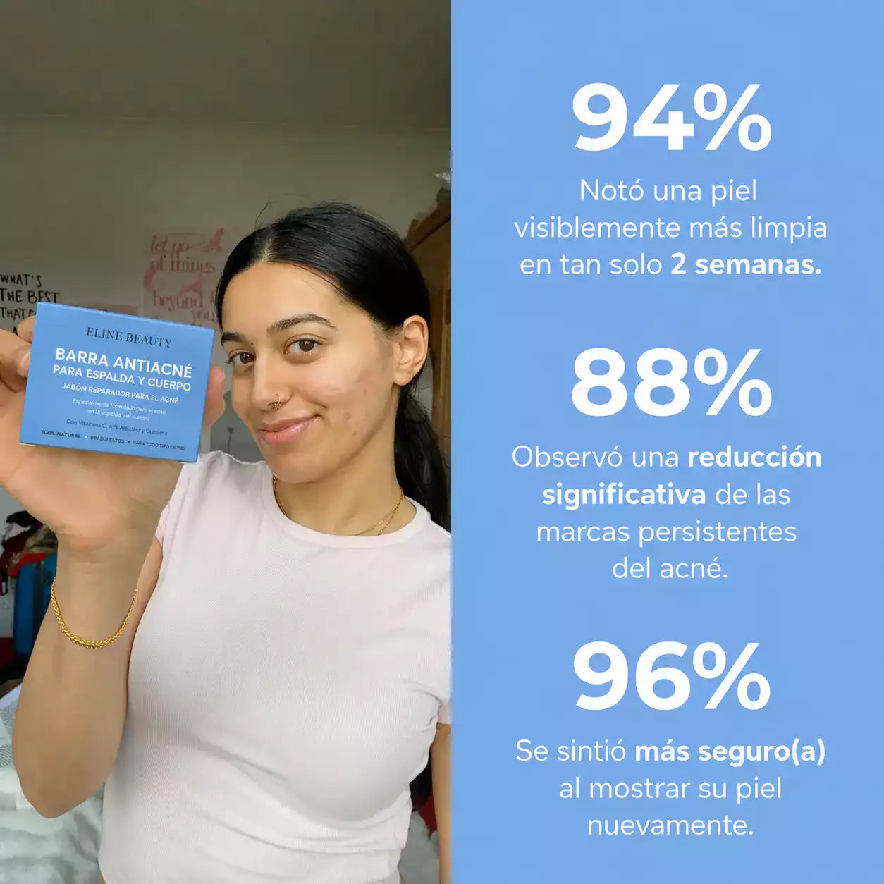 Barra Antiacné para Espalda y Cuerpo™