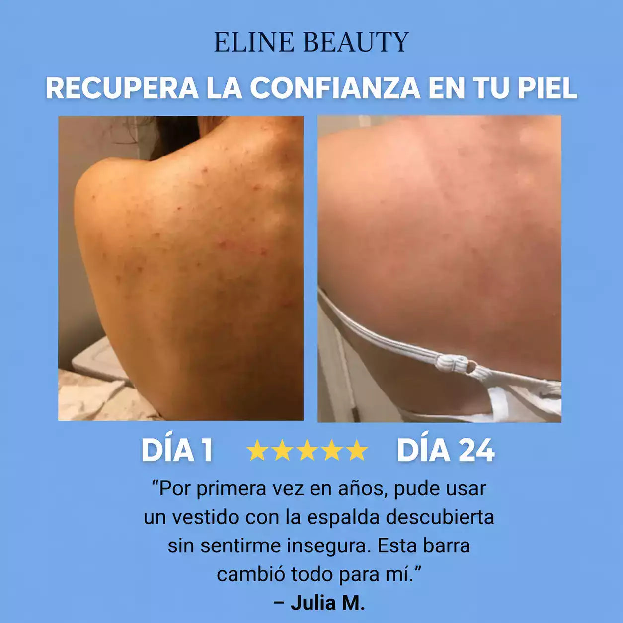 Barra Antiacné para Espalda y Cuerpo™
